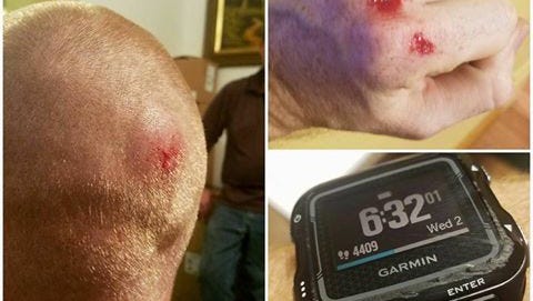 Dean Hunsucker sustained injuries to his head and hands when he tackled a suspect being chased by Indianapolis Metropolitan Police last week. His post detailing the event has been shared on Facebook by more than 4,000 people.